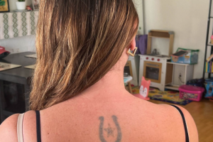 Why Tattoo Removal Can Be a Good Decision