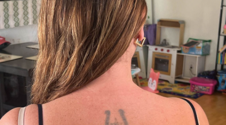 Why Tattoo Removal Can Be a Good Decision