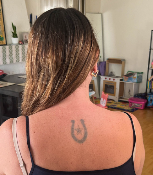 Why Tattoo Removal Can Be a Good Decision