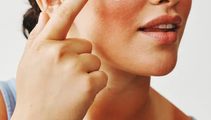 How to Naturally Treat Sunburn and Soothe Your Skin